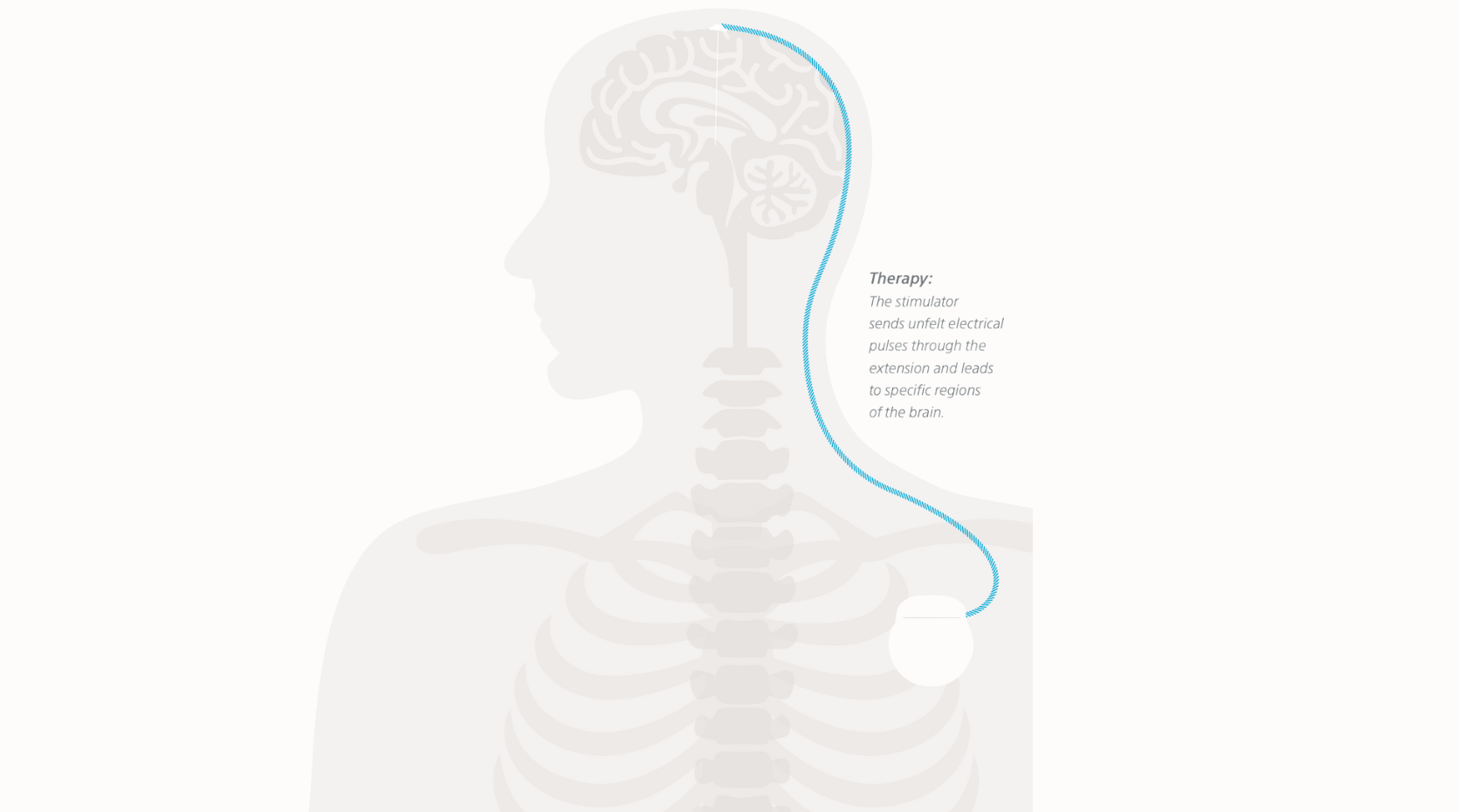 Copy of Parkinson's Life header images.png